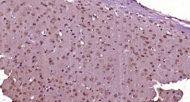 SRRM4 Antibody in Immunohistochemistry (Paraffin) (IHC (P))