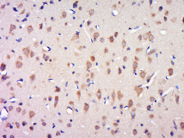 CCDC124 Antibody in Immunohistochemistry (Paraffin) (IHC (P))