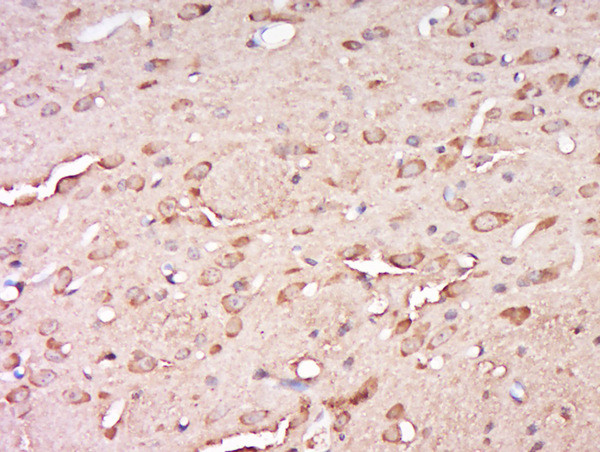CCDC82 Antibody in Immunohistochemistry (Paraffin) (IHC (P))