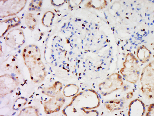 CCDC30 Antibody in Immunohistochemistry (Paraffin) (IHC (P))