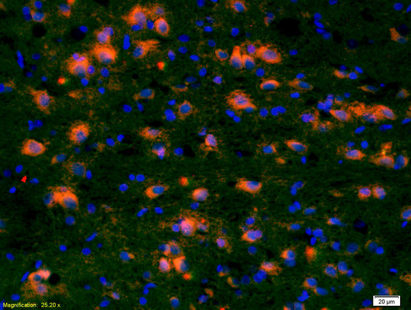 CCDC12 Antibody in Immunohistochemistry (Paraffin) (IHC (P))