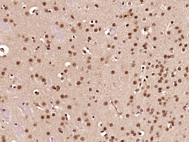 CCDC42 Antibody in Immunohistochemistry (Paraffin) (IHC (P))