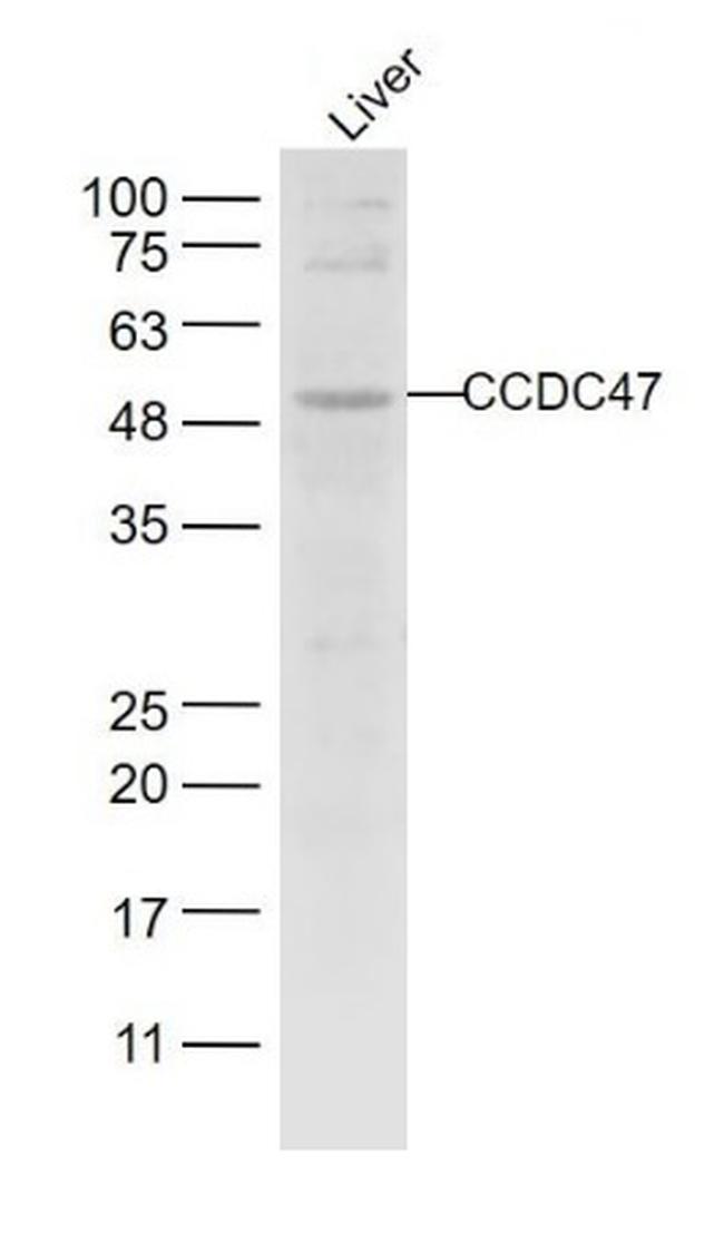 CCDC47 Antibody in Western Blot (WB)