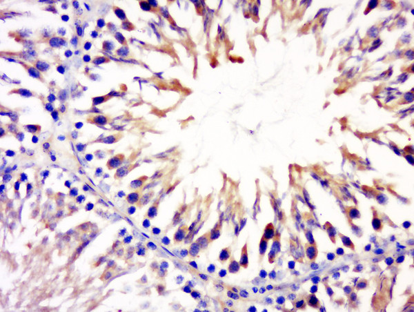 CCDC54 Antibody in Immunohistochemistry (Paraffin) (IHC (P))