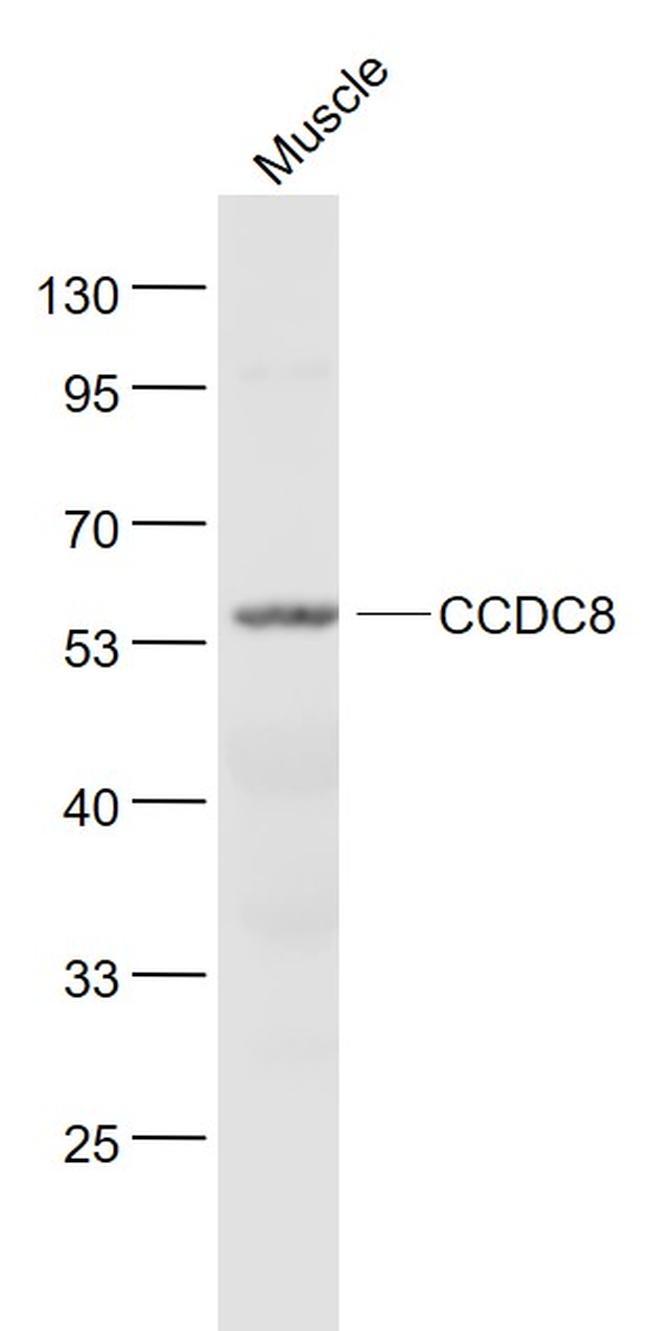 CCDC8 Antibody in Western Blot (WB)