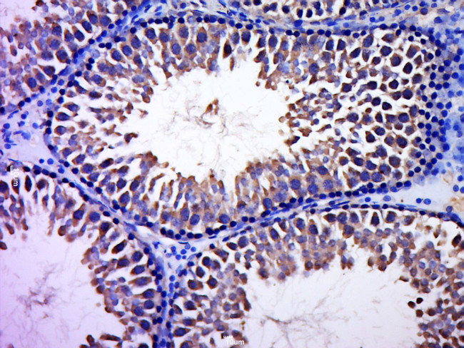 CCDC93 Antibody in Immunohistochemistry (Paraffin) (IHC (P))