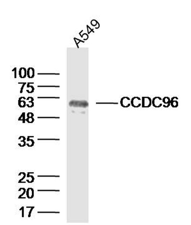 CCDC96 Antibody in Western Blot (WB)