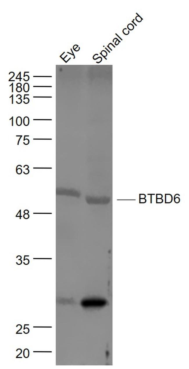 BTBD6 Antibody in Western Blot (WB)