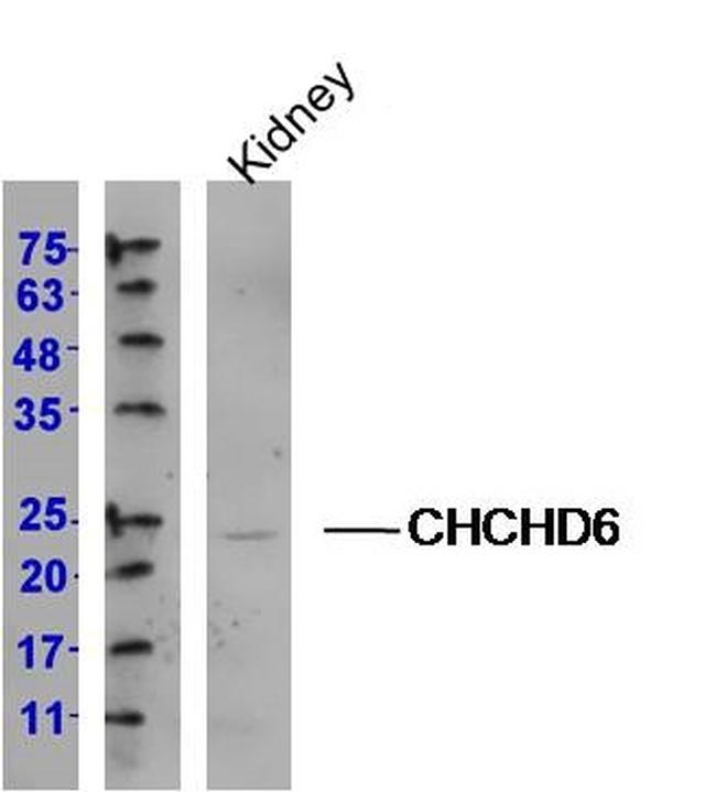 CHCHD6 Antibody in Western Blot (WB)
