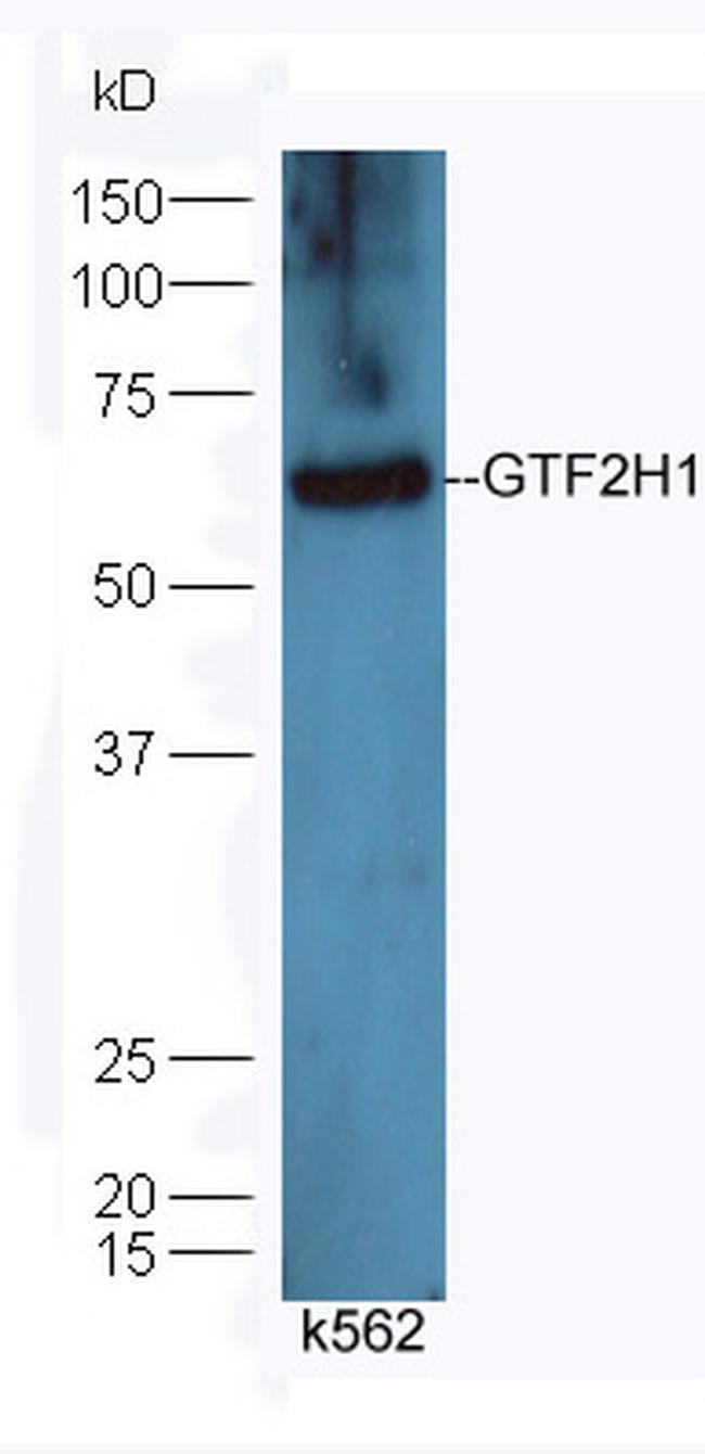 GTF2H1 Antibody in Western Blot (WB)