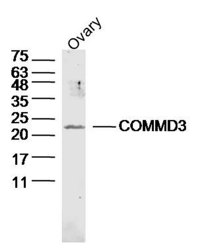 COMMD3 Antibody in Western Blot (WB)