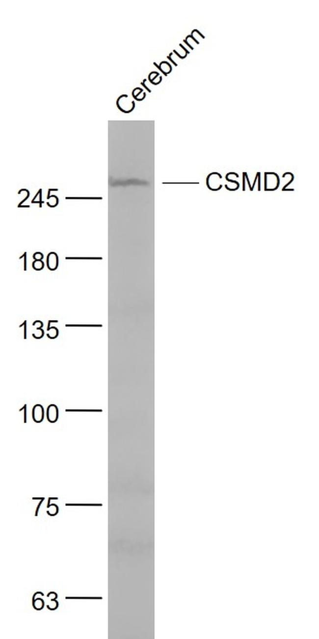 CSMD2 Antibody in Western Blot (WB)