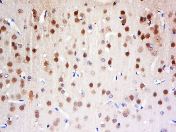 FAM13C1 Antibody in Immunohistochemistry (Paraffin) (IHC (P))