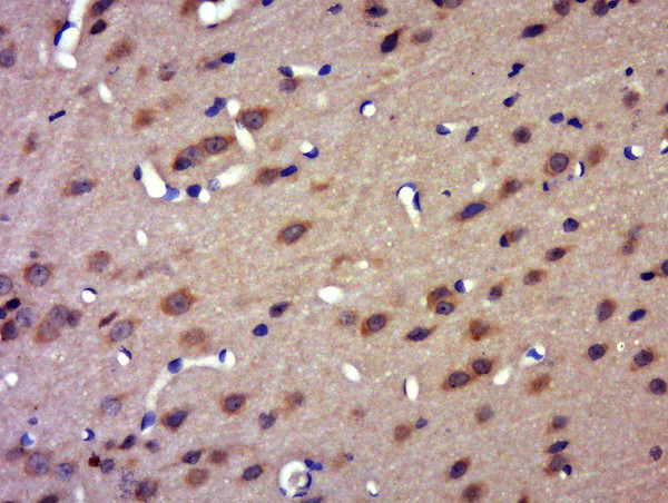 FAM161B Antibody in Immunohistochemistry (Paraffin) (IHC (P))