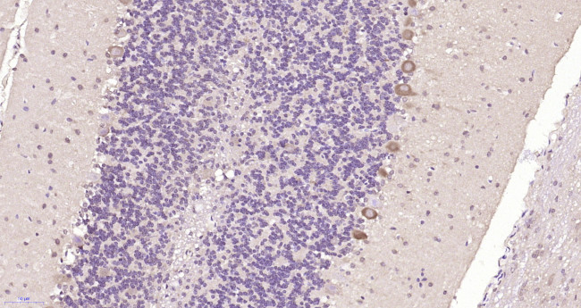 FRMD4B Antibody in Immunohistochemistry (Paraffin) (IHC (P))