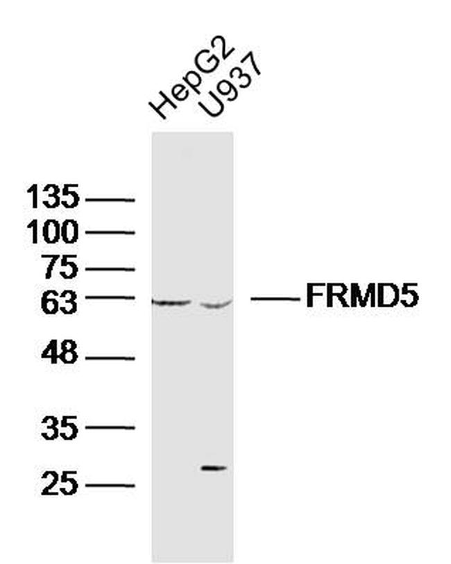 FRMD5 Antibody in Western Blot (WB)