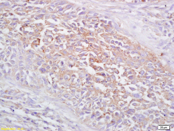 FRMD6 Antibody in Immunohistochemistry (Paraffin) (IHC (P))