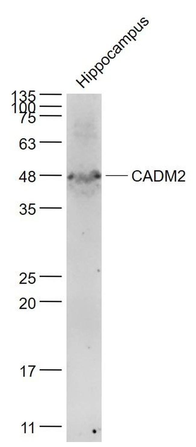 CADM2 Antibody in Western Blot (WB)