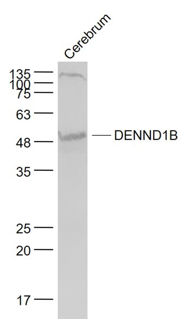 DENND1B Antibody in Western Blot (WB)