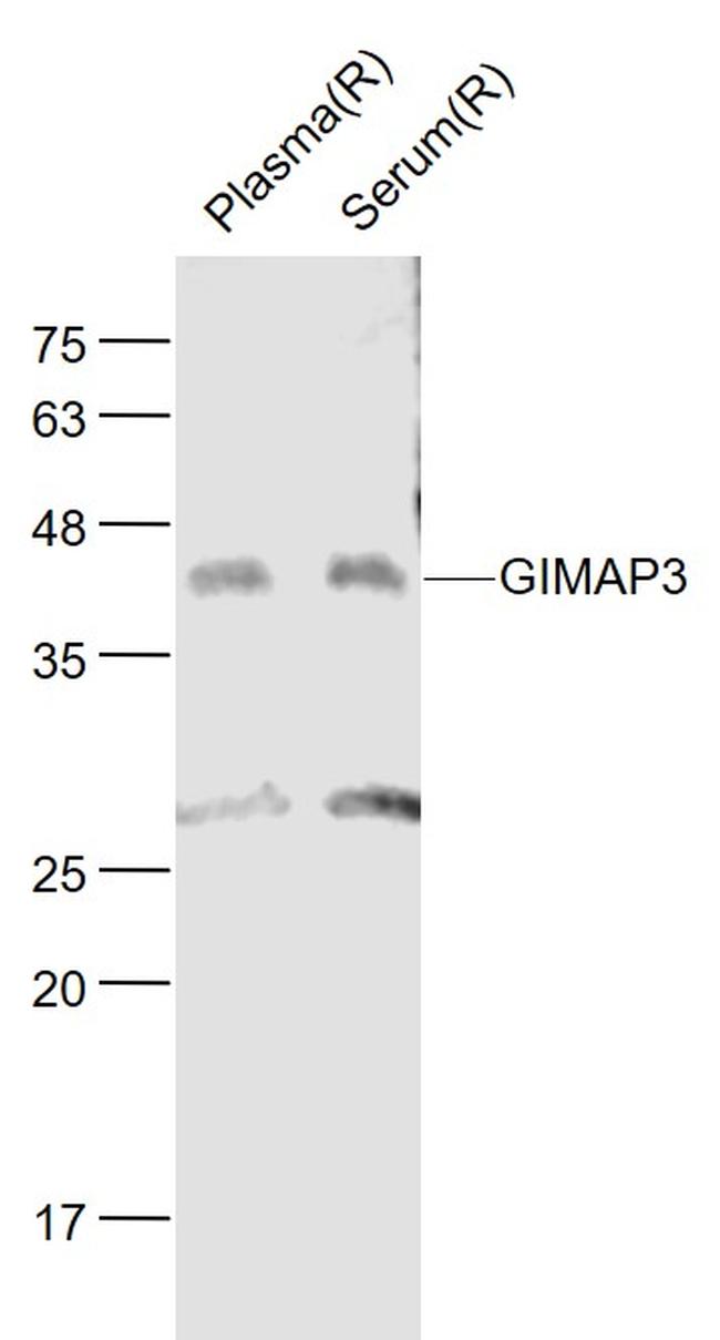 GIMAP3 Antibody in Western Blot (WB)