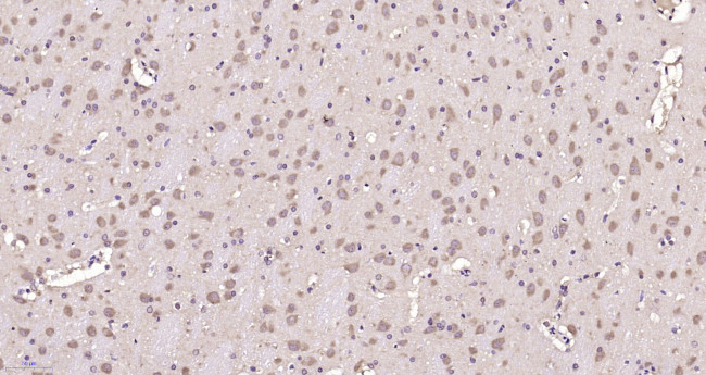 GPRIN3 Antibody in Immunohistochemistry (Paraffin) (IHC (P))