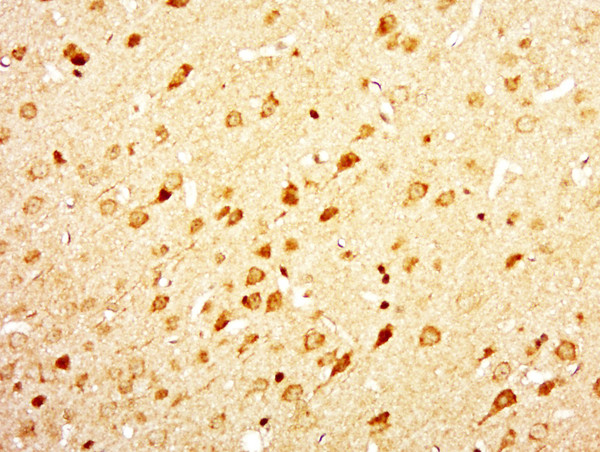 DIRC2 Antibody in Immunohistochemistry (Paraffin) (IHC (P))