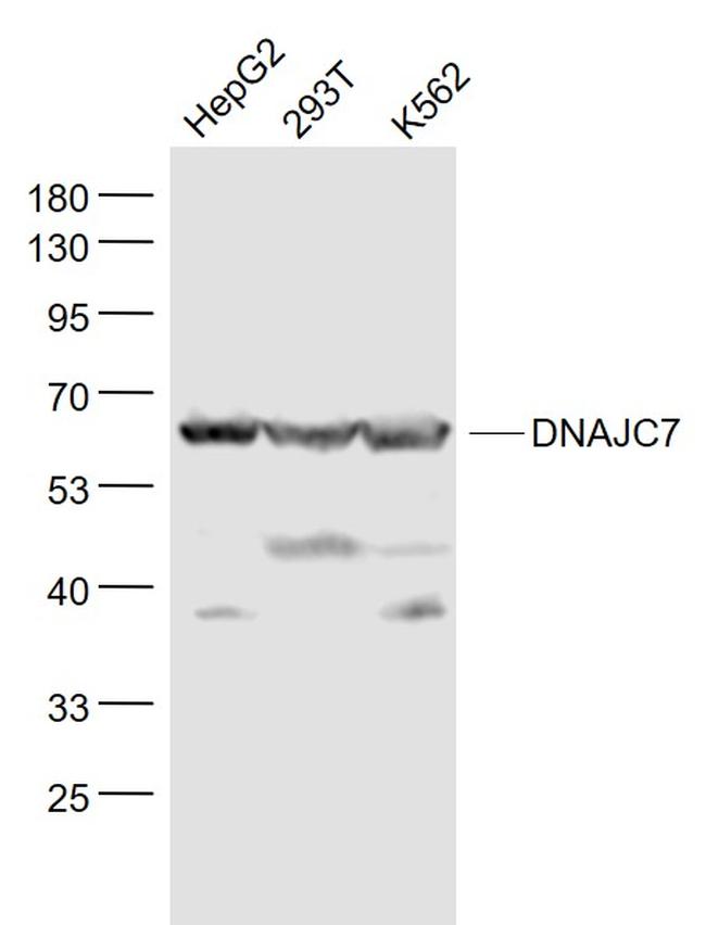 DNAJC7 Antibody in Western Blot (WB)