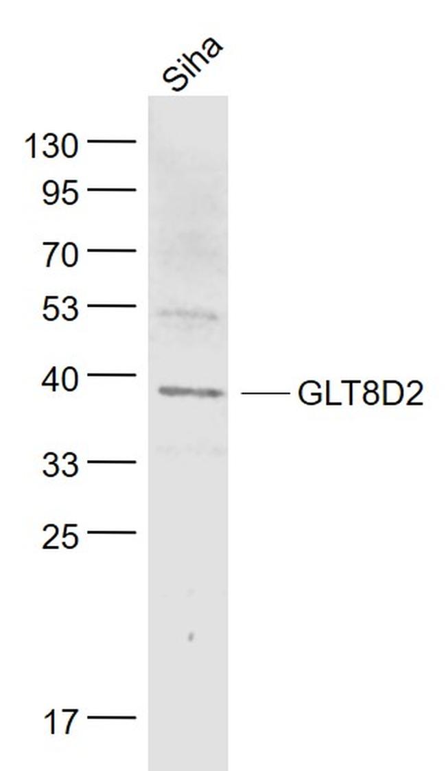 GLT8D2 Antibody in Western Blot (WB)