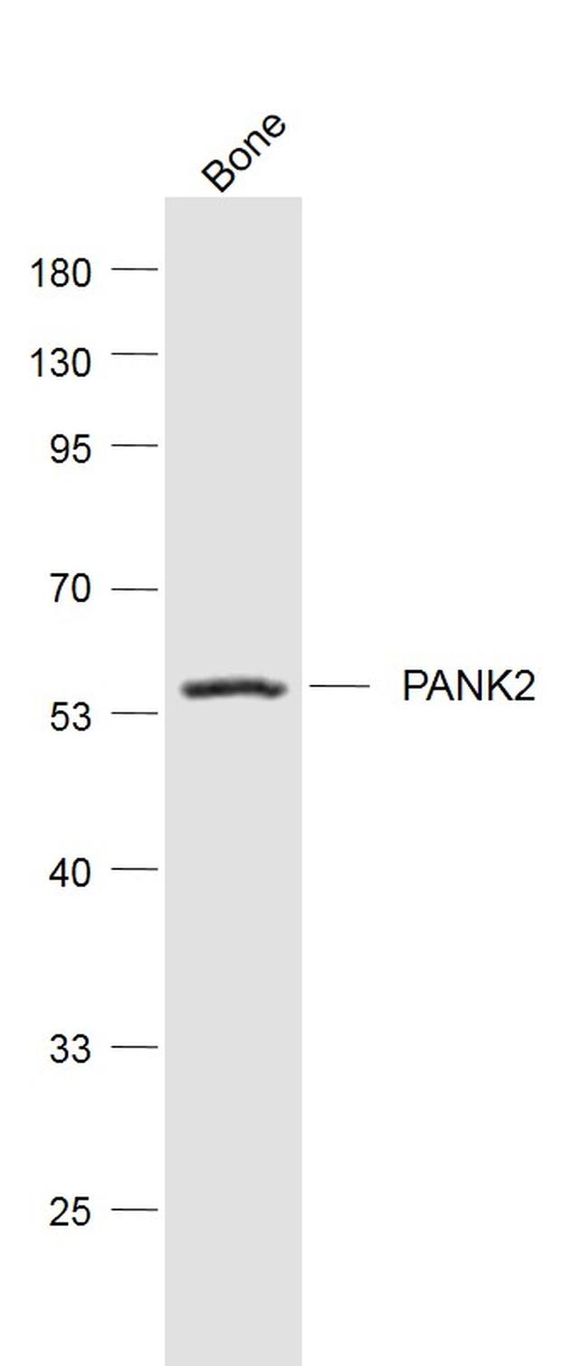 PANK2 Antibody in Western Blot (WB)