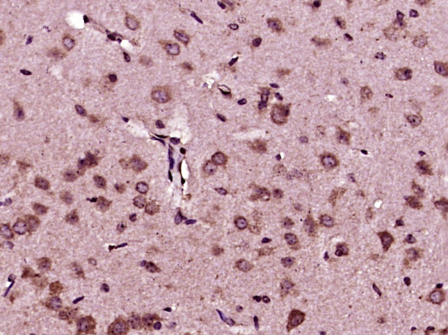 SUMO-1 Antibody in Immunohistochemistry (Paraffin) (IHC (P))