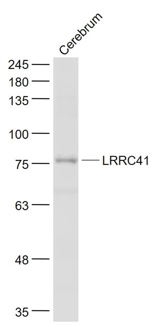 LRRC41 Antibody in Western Blot (WB)