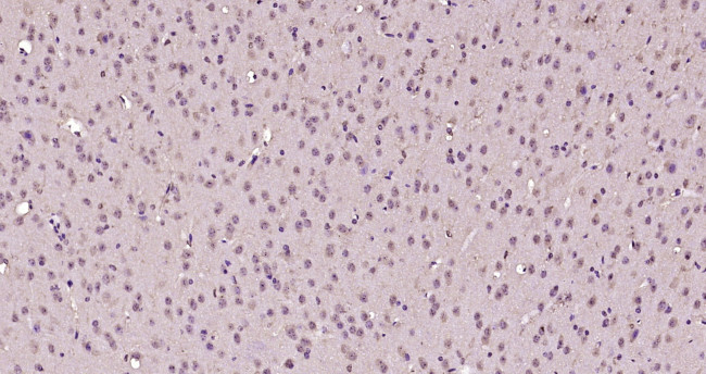 EGR2 Antibody in Immunohistochemistry (Paraffin) (IHC (P))