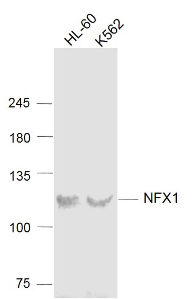 NFX1 Antibody in Western Blot (WB)