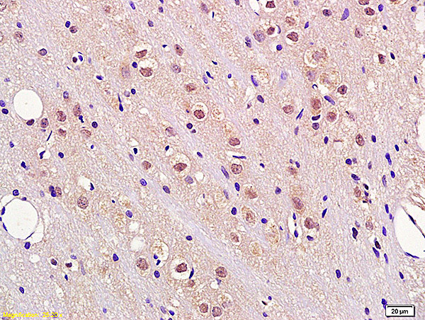 Fbxw7 Antibody in Immunohistochemistry (Paraffin) (IHC (P))