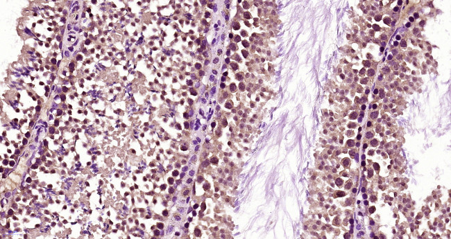 Fbx15 Antibody in Immunohistochemistry (Paraffin) (IHC (P))