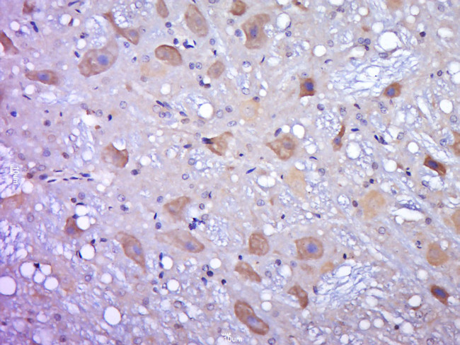 OGFOD2 Antibody in Immunohistochemistry (Paraffin) (IHC (P))