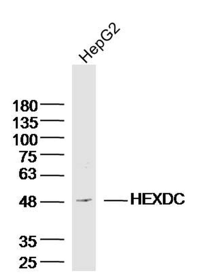 HEXDC Antibody in Western Blot (WB)