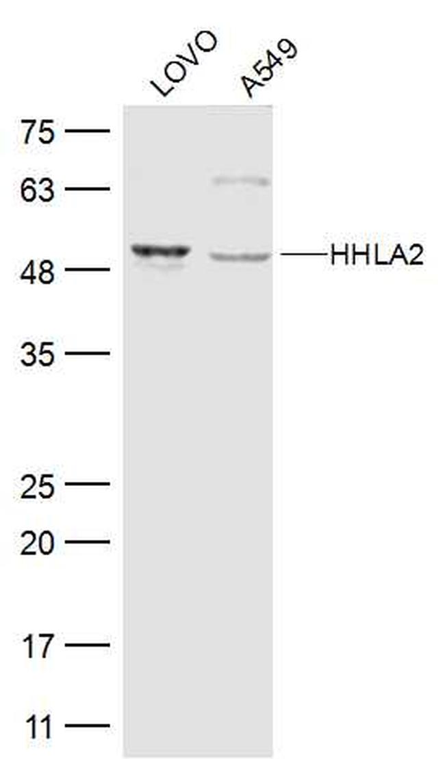 HHLA2 Antibody in Western Blot (WB)