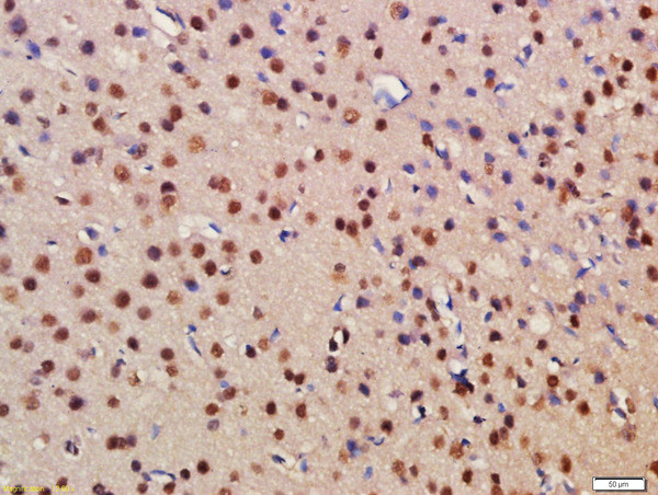 BRD1 Antibody in Immunohistochemistry (Paraffin) (IHC (P))