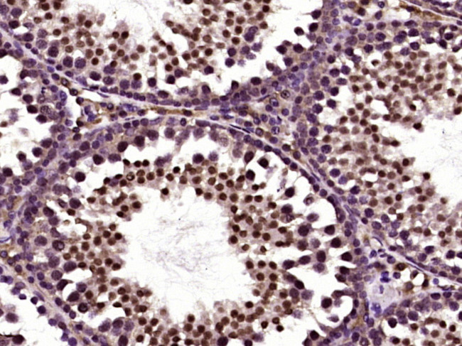 Lin28A/B Antibody in Immunohistochemistry (Paraffin) (IHC (P))