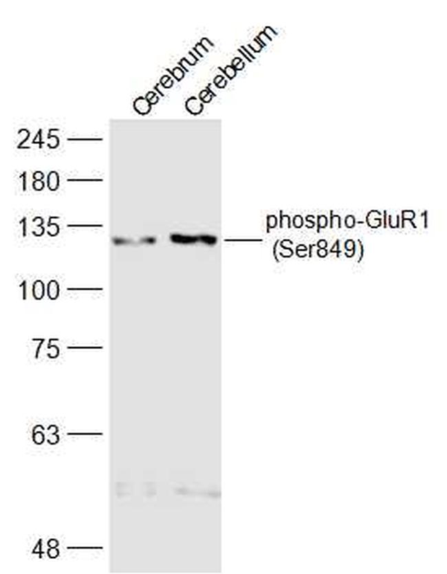Phospho-GluR1 (Ser849) Antibody in Western Blot (WB)