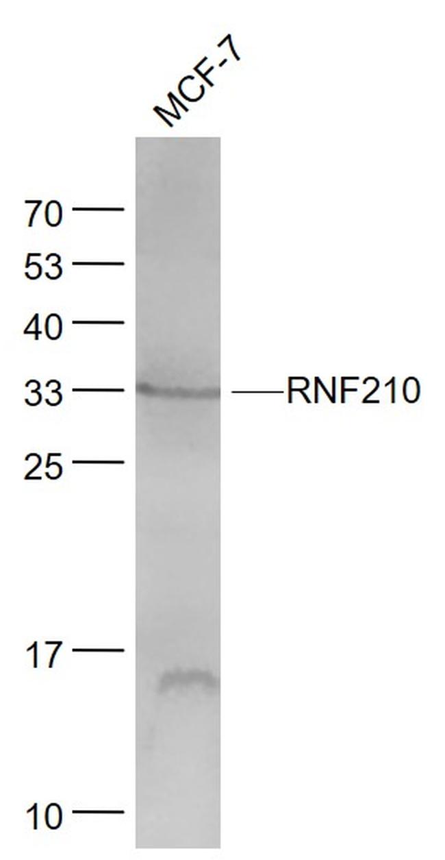 RNF210 Antibody in Western Blot (WB)