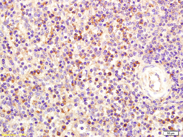 FCER1A Antibody in Immunohistochemistry (Paraffin) (IHC (P))