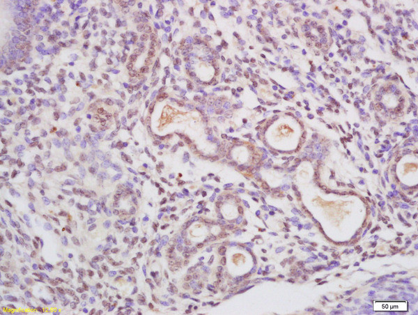 C23 Antibody in Immunohistochemistry (Paraffin) (IHC (P))