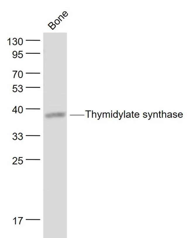 Thymidylate synthase Antibody in Western Blot (WB)