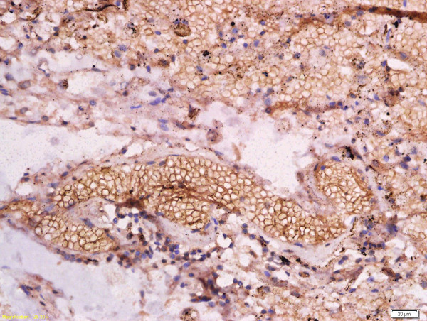HBB + HBD Antibody in Immunohistochemistry (Paraffin) (IHC (P))