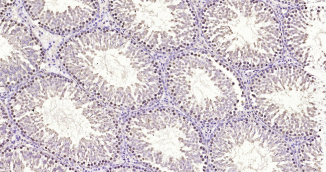 Ubiquityl-Histone H2A.X (Lys119) Antibody in Immunohistochemistry (Paraffin) (IHC (P))