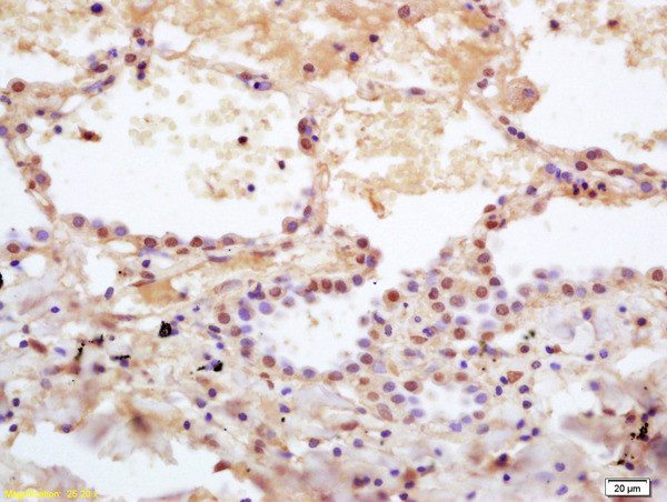 DHRS2 Antibody in Immunohistochemistry (Paraffin) (IHC (P))