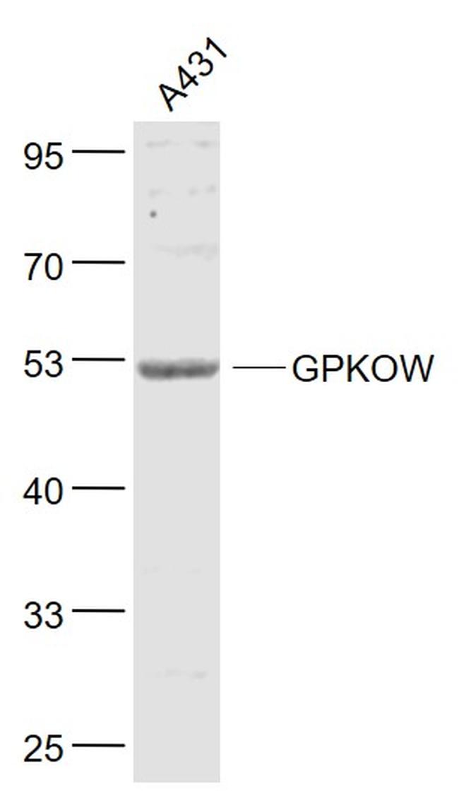 GPKOW Antibody in Western Blot (WB)