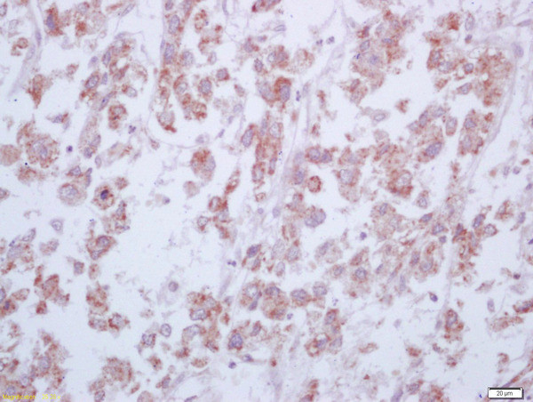 Arginase 1 Antibody in Immunohistochemistry (Paraffin) (IHC (P))